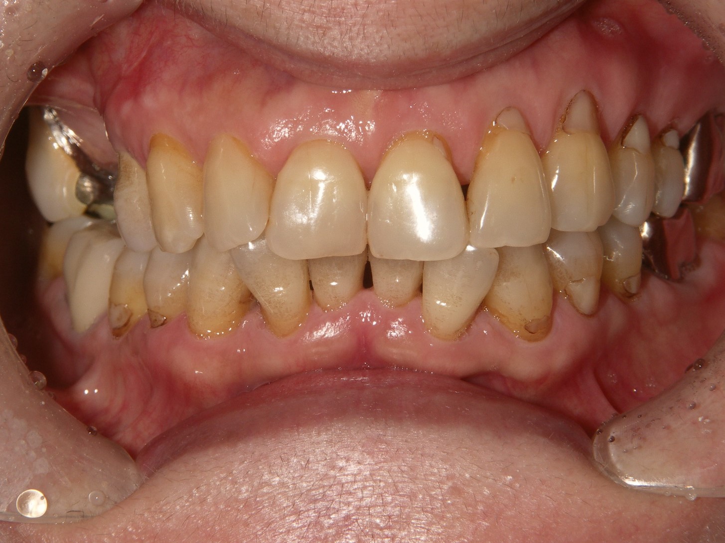 Before