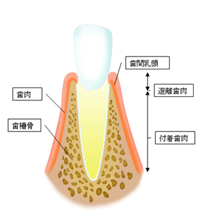 第2回　歯茎が変な時