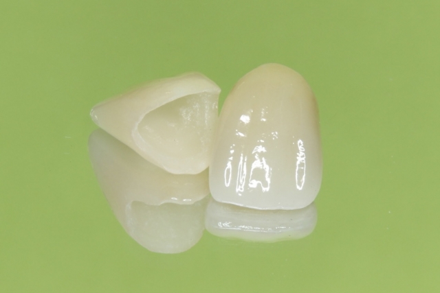 歯の詰め物、被せ物が取れた・飲み込んでしまった